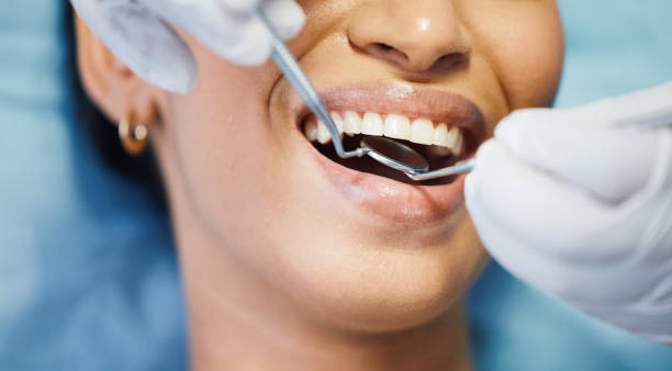 Best Holiday Emergency Dentist in Fairmount Heights, MD