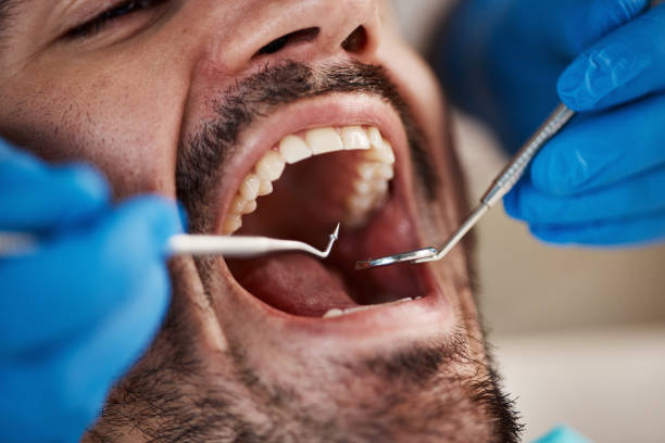 Best Emergency Dental Extractions in Fairmount Heights, MD